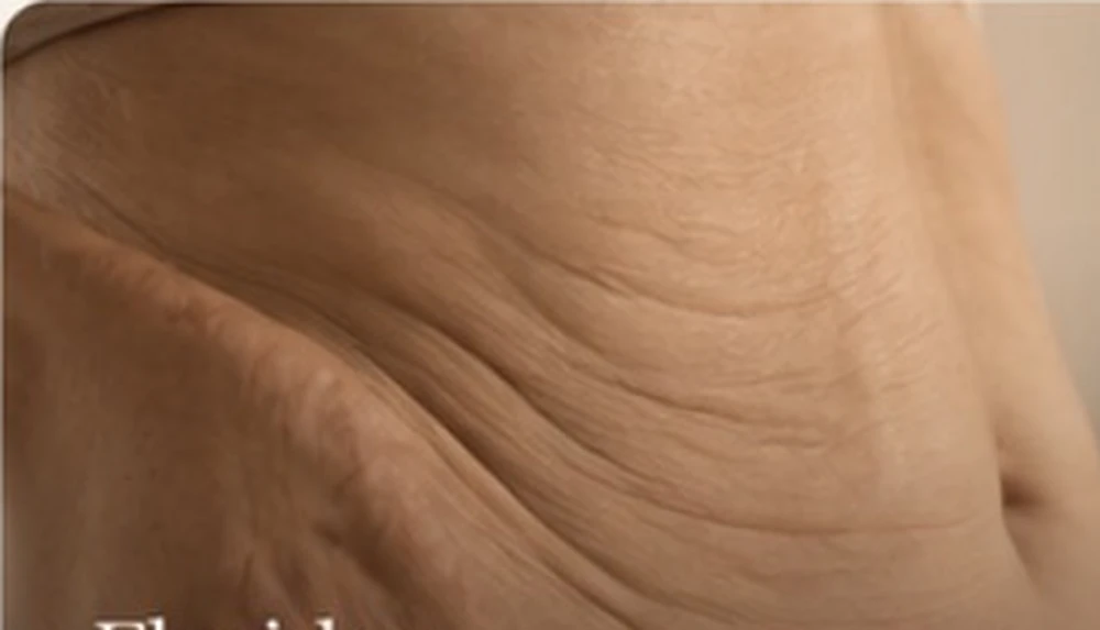Flacidez da pele na região abdominal