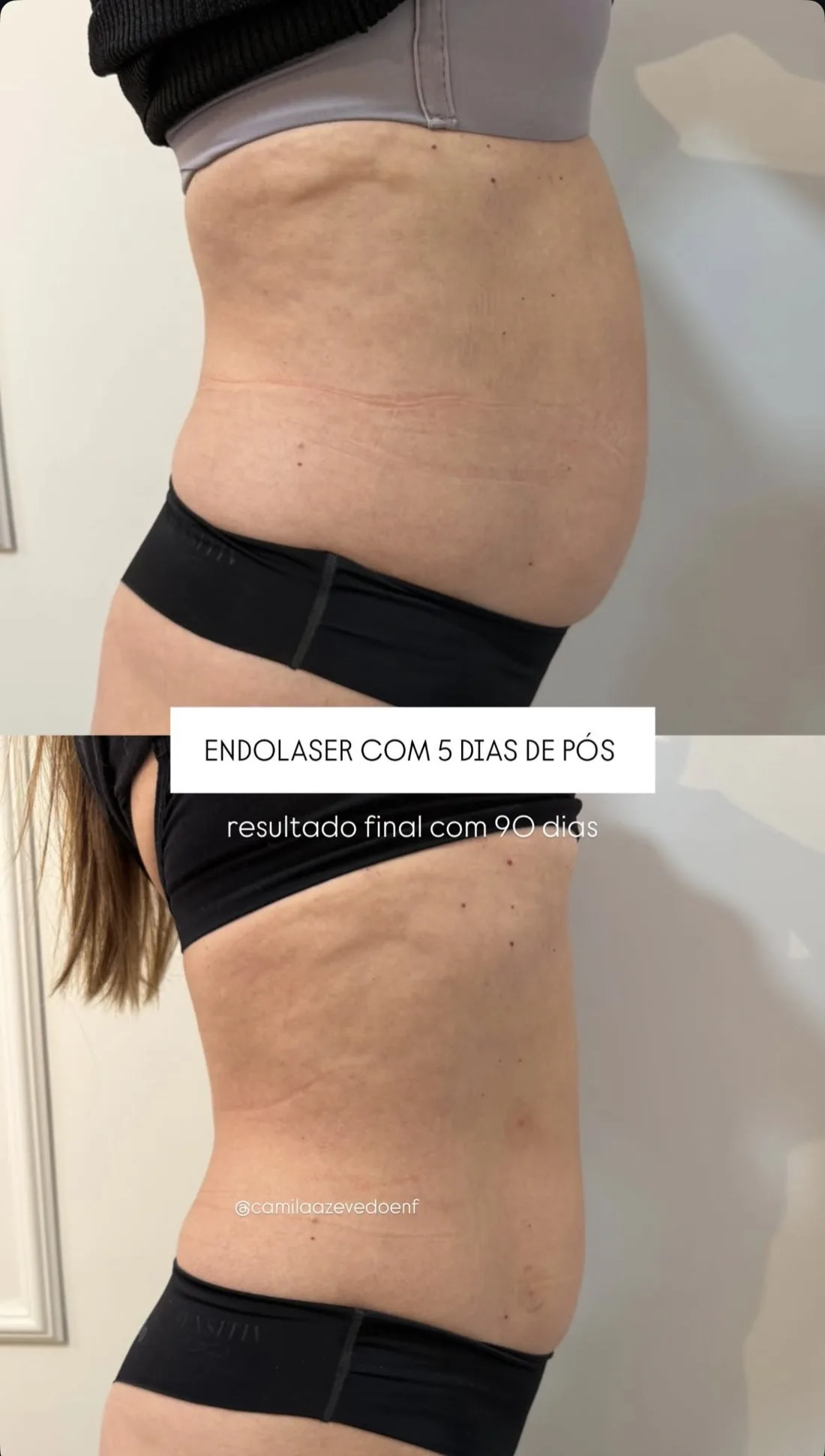 Registro de acompanhamento e resultados de Endolaser 8